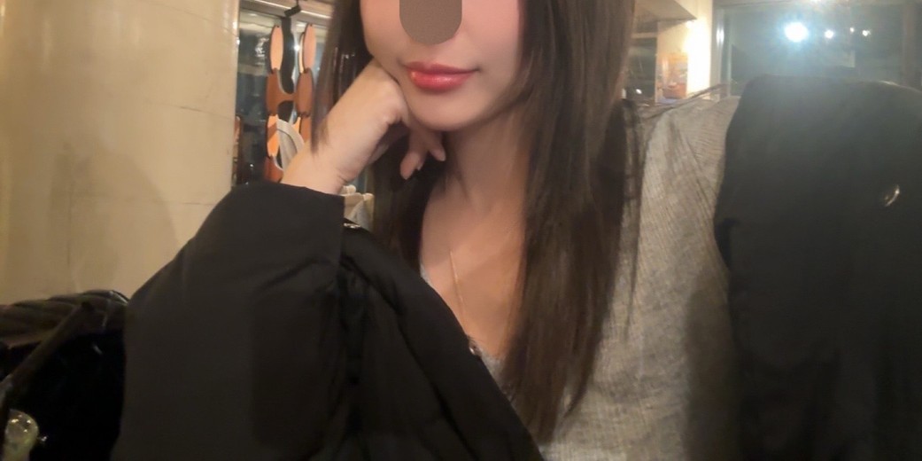 after photo: 입술필러