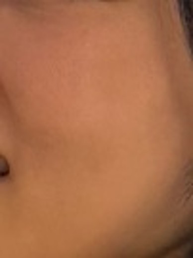 before photo: ルメッカ