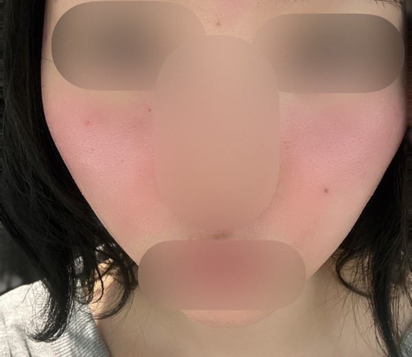 after photo: 診断・検査
