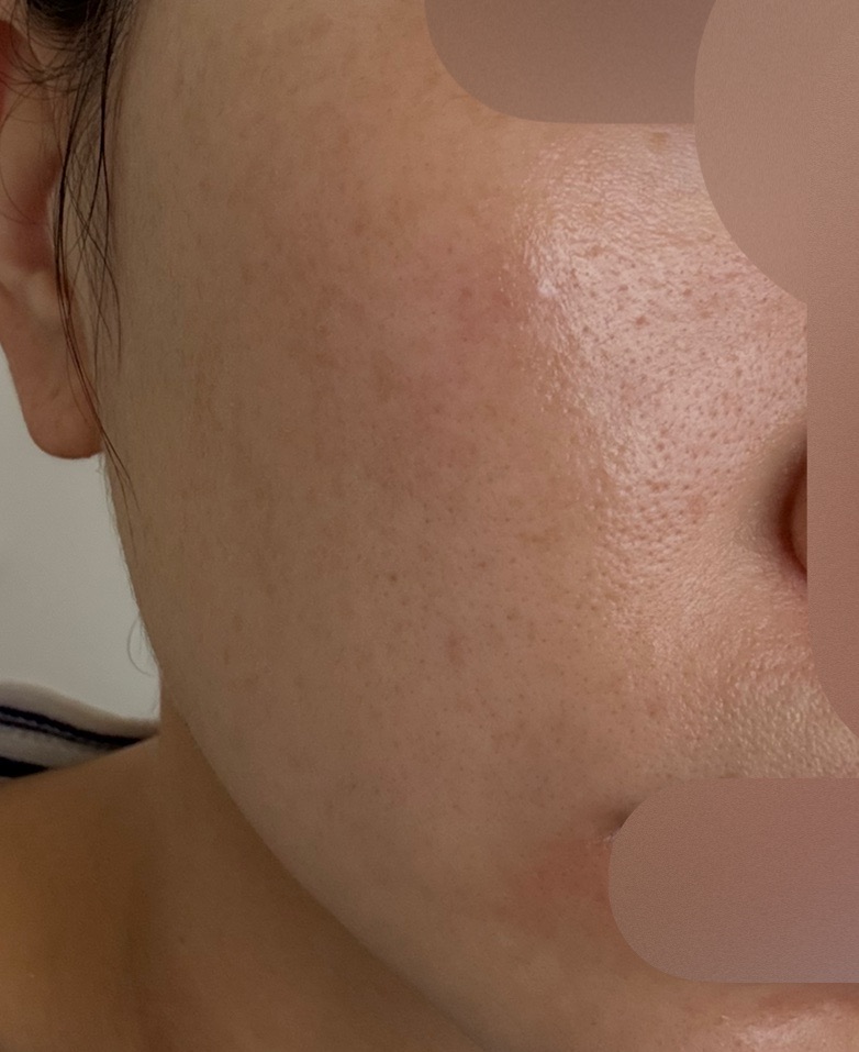 セルフでもサロンでも♪フォトフェイシャルエステ 約200万人が利用したセルフエステ「じぶんdeエステ」が美容展示