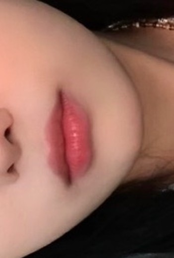 before photo: 윤곽주사, 사각턱보톡스