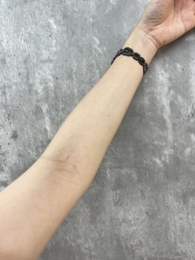 before photo: 白玉注射・点滴, ビタミン注射・点滴