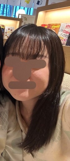 before photo: ポテンツァ(POTENZA), 高周波(RF), マックーム(McCoom)