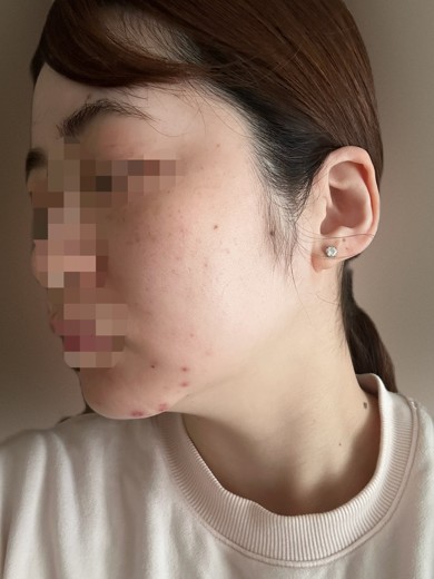 after photo: 診断・検査