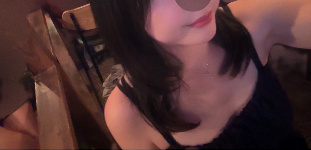 before photo: 입술필러