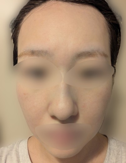 after photo: ルメッカ