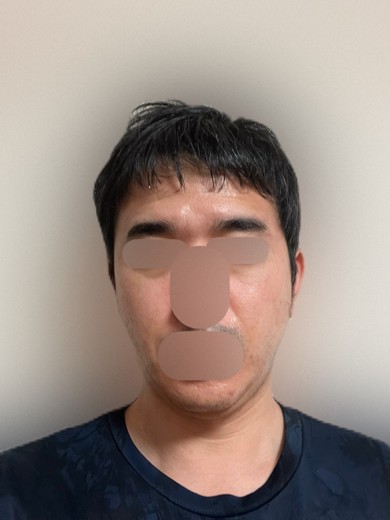 after photo: 白玉注射・点滴