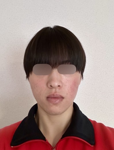 before photo: マックーム(McCoom)