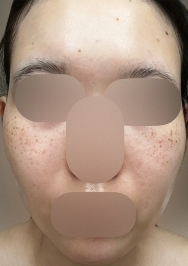 after photo: ルメッカ
