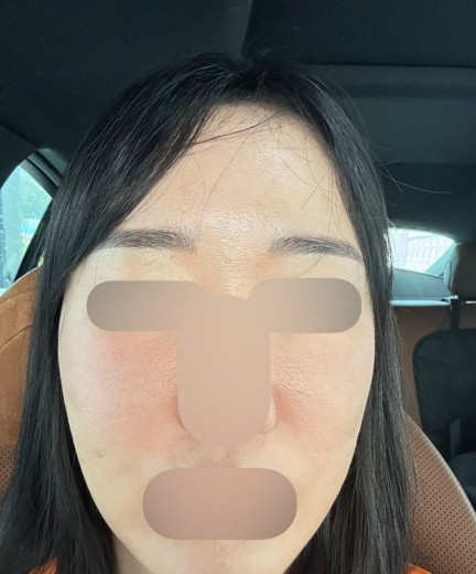 after photo: 엘라비에리투오