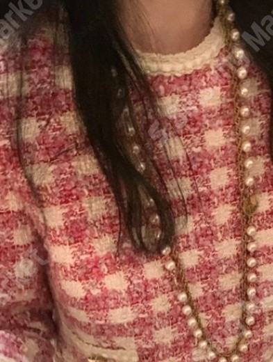 before photo: 윤곽주사