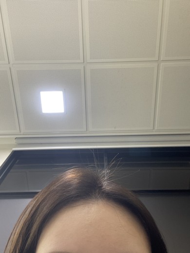 before photo: 여드름압출