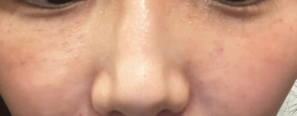 ご縁ある方にお譲りします！様REJURAN ×2本、stem cell 1本 REJURAN COSMETICS / c-PDRN ターンオーバー クリームの公式商品情報