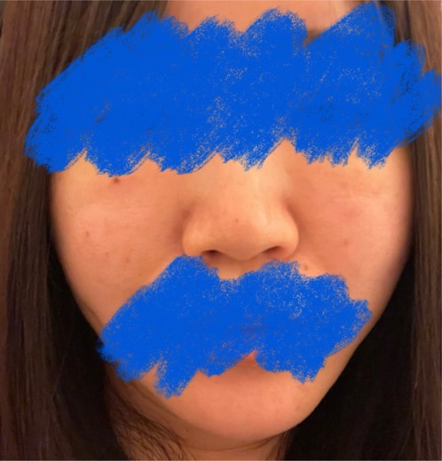 after photo: ポテンツァ(POTENZA)
