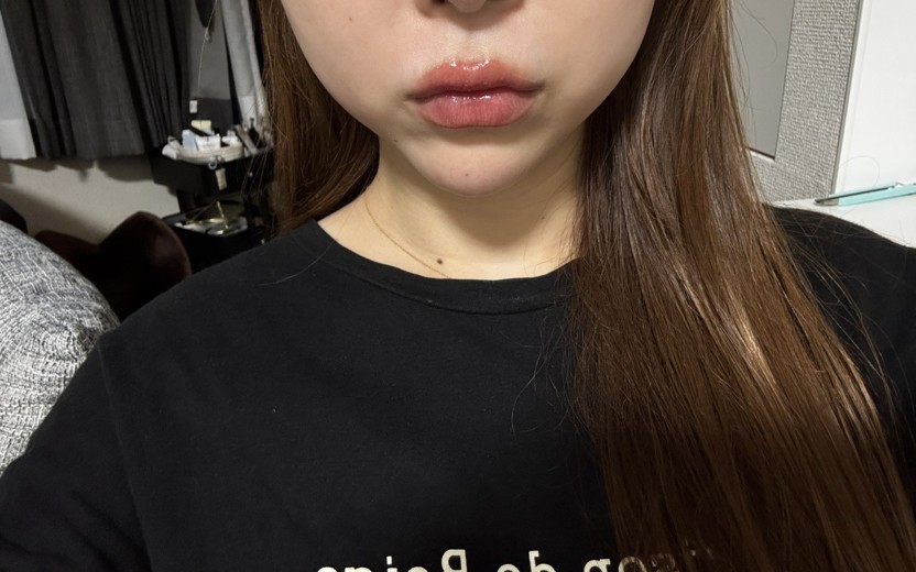 after photo: リニアファーム(ハイフ)