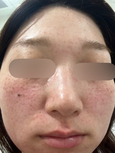 after photo: リズネ(LIZNE)