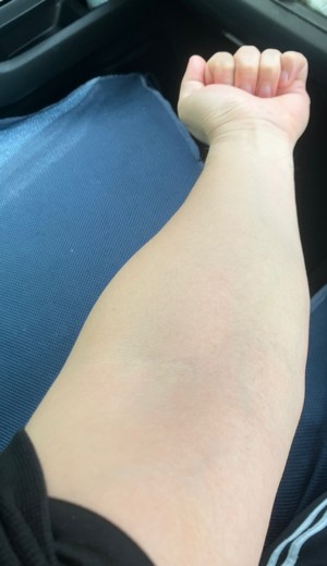 before photo: 白玉注射・点滴