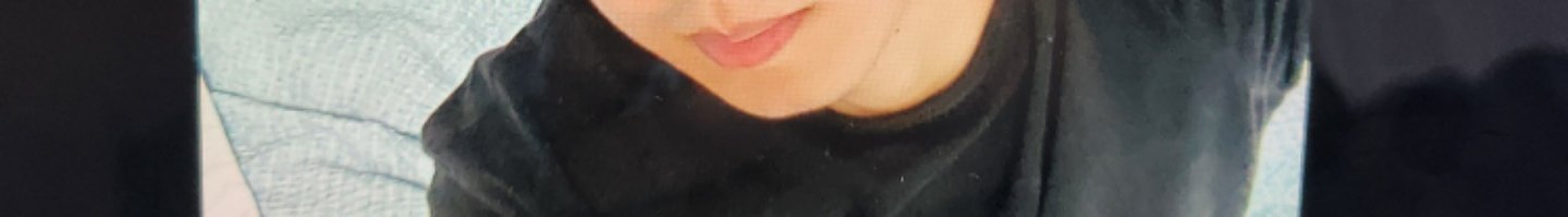 before photo: 턱끝필러