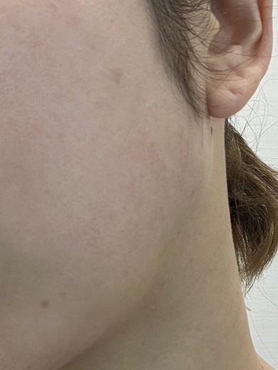 before photo: エレクトロポレーション, 診断・検査