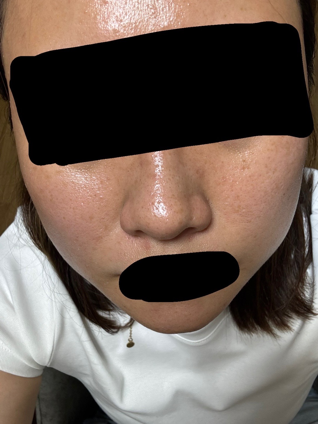 脱毛 医療脱毛 | ZX-CLINIC【公式】｜大阪梅田・北新地からすぐの安く