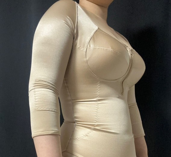 after photo: 전신지방흡입