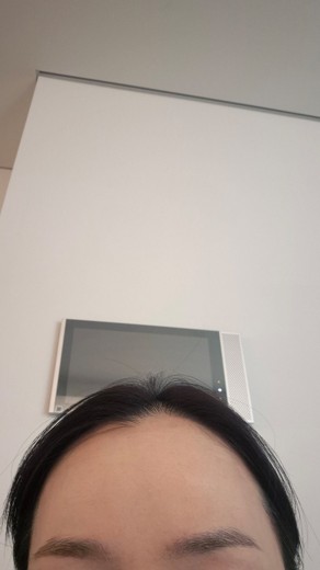 after photo: 쥬브젠