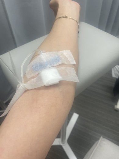 before photo: 白玉注射・点滴