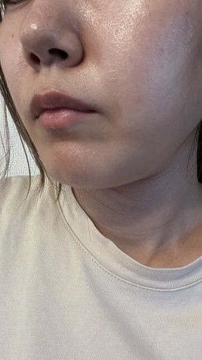 before photo: ジュベルック(Juvelook)