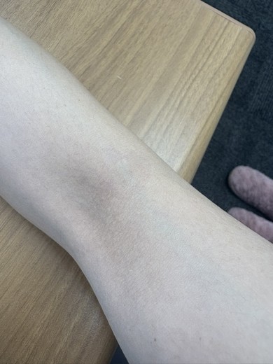 after photo: ビタミン注射・点滴