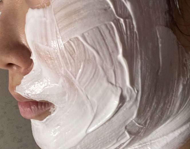 after photo: 리쥬란힐러