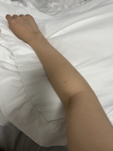 before photo: 白玉注射・点滴