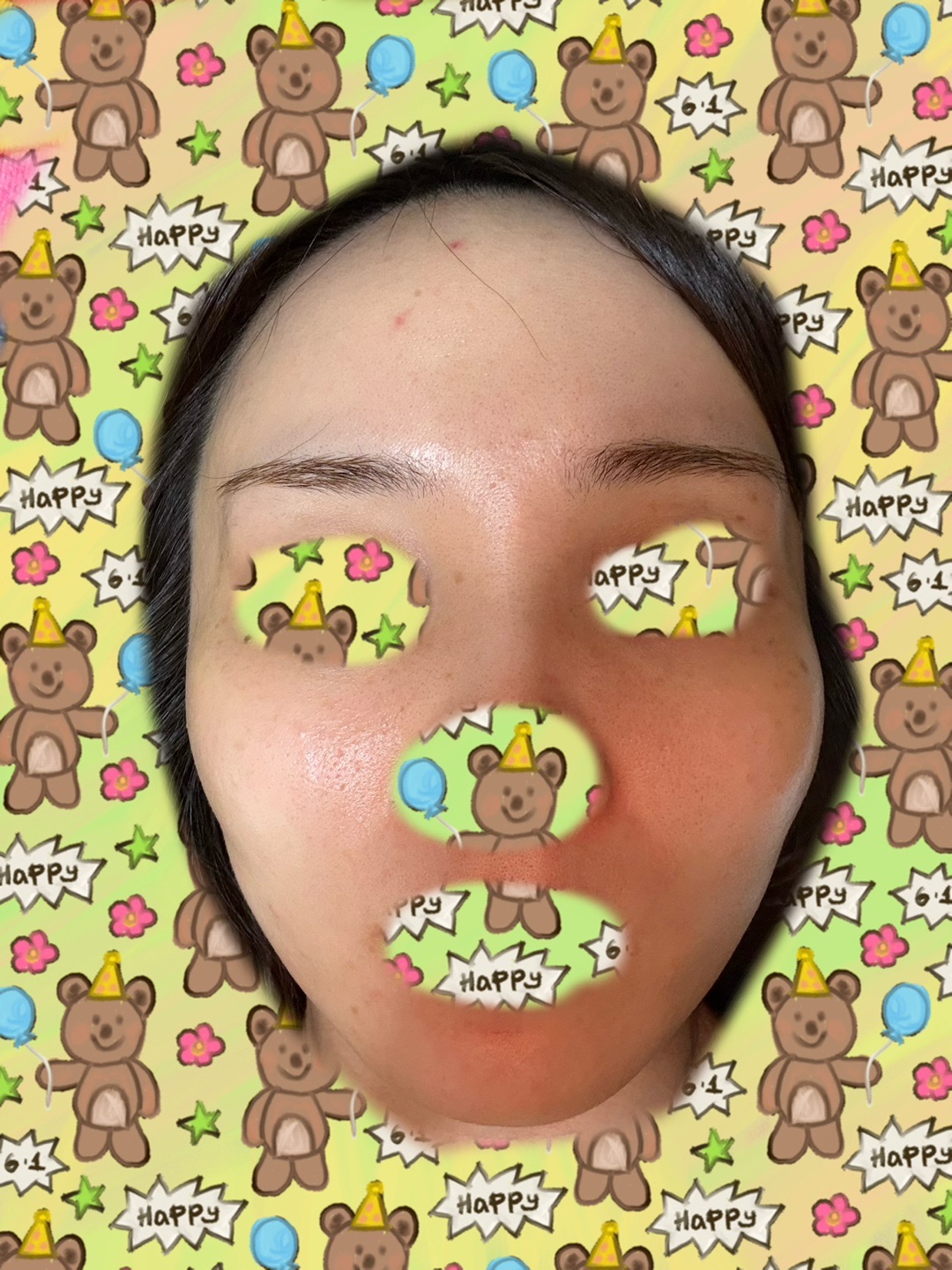 何度でも可】【女性限定】顔脱毛｜ジェントルマックスプロ／ジェントル