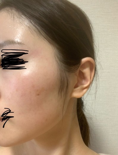 after photo: ルメッカ