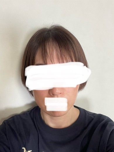 after photo: ソノクイーン(ハイフ)