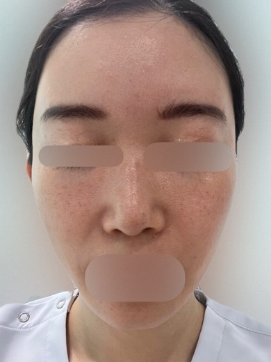 after photo: ルメッカ