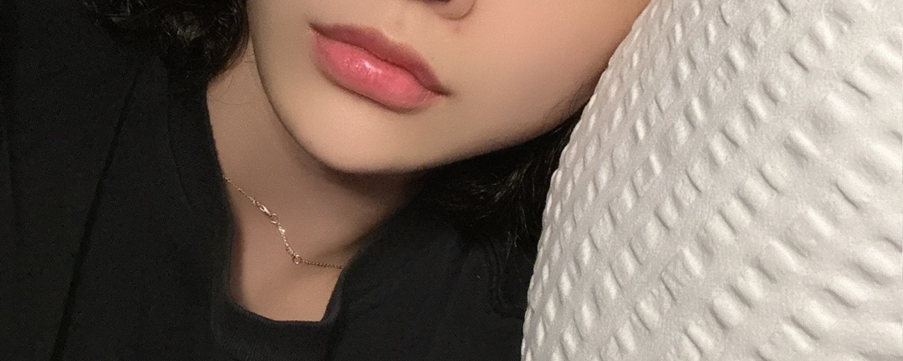 after photo: 턱끝필러