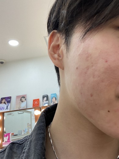 after photo: ポテンツァ(POTENZA)