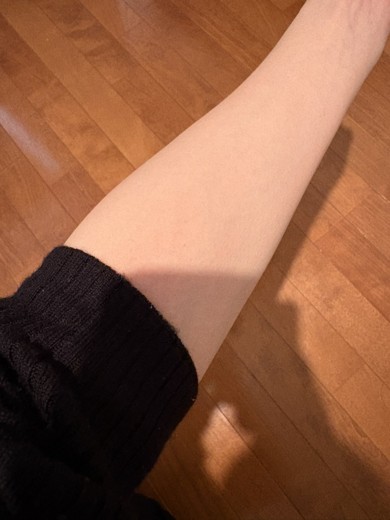 before photo: 美容注射・点滴