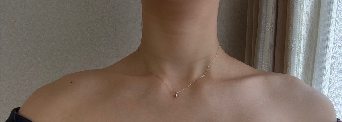 after photo: 肩ボトックス(僧帽筋)
