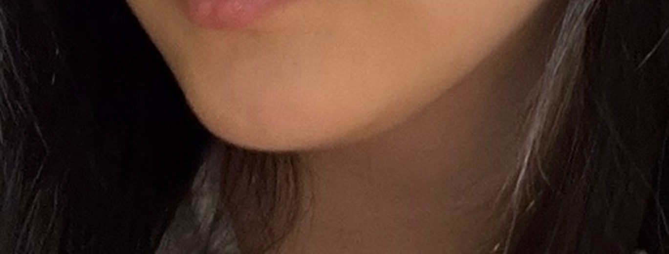 after photo: 슈링크유니버스