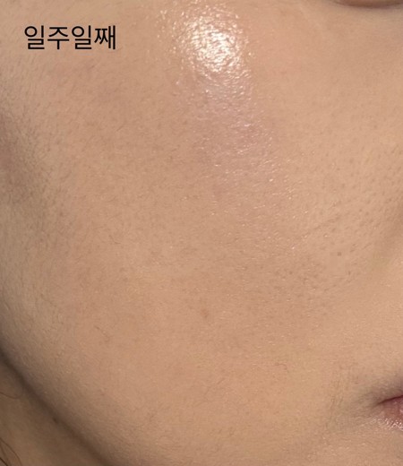 after photo: 쥬베룩