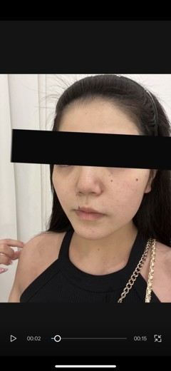 before photo: ヴェルベットスキン