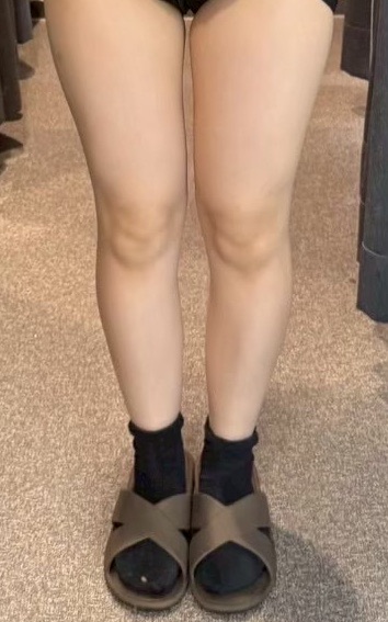 プランエスクリニックの口コミ・料金 | カンナムオンニ