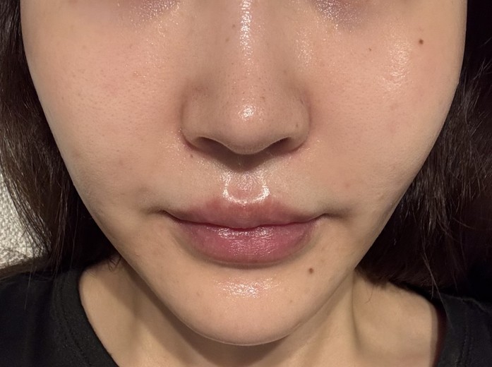 before photo: ジュベルック(Juvelook)