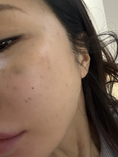 after photo: 쥬베룩