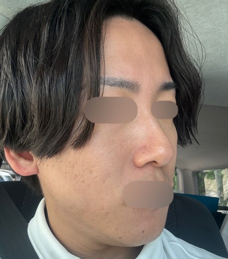 after photo: ポテンツァ(POTENZA)