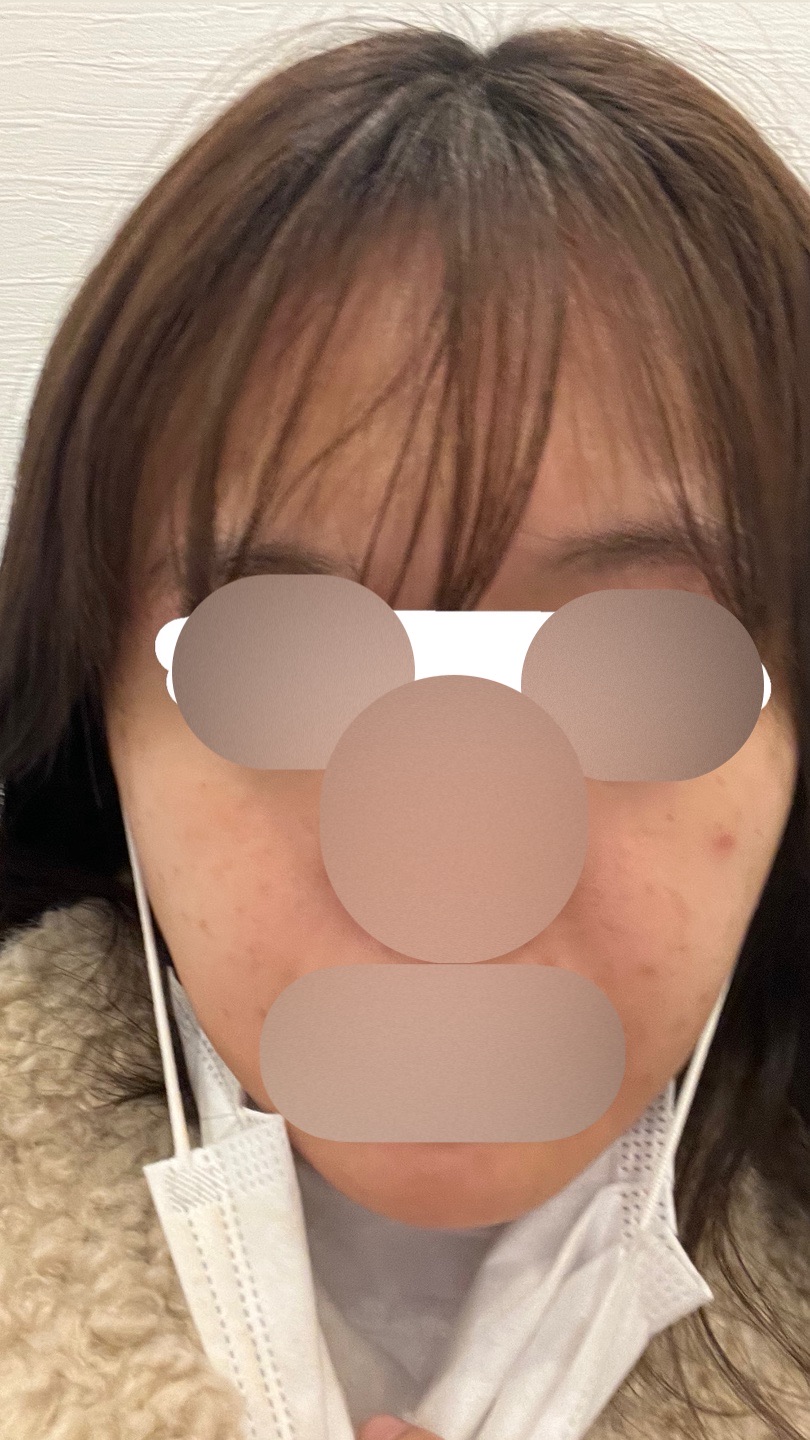 ZX-CLINIC【ゼクスクリニック】 小田 惣也 | カンナムオンニ｜国内利用