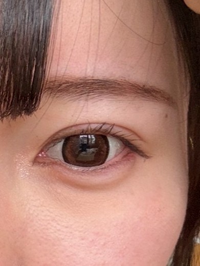 after photo: ヴェルベットスキン