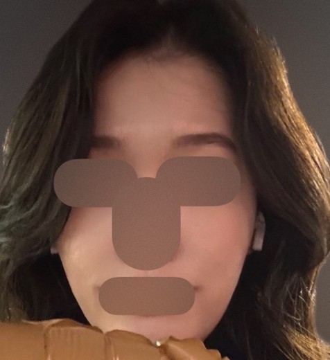 after photo: 소노케어