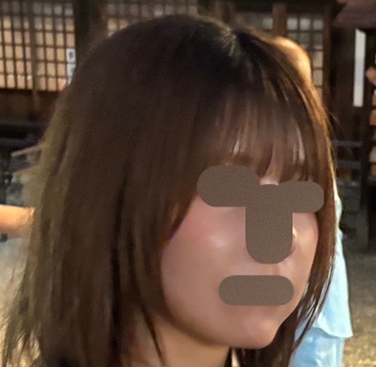 after photo: 美容注射・点滴